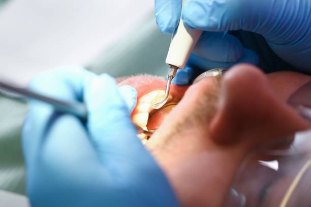 Best Emergency TMJ Treatment in Yankton, SD