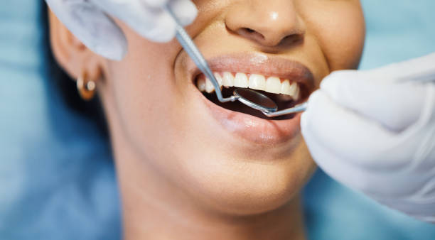 Best Urgent Care for Lost Fillings or Crowns in Yankton, SD
